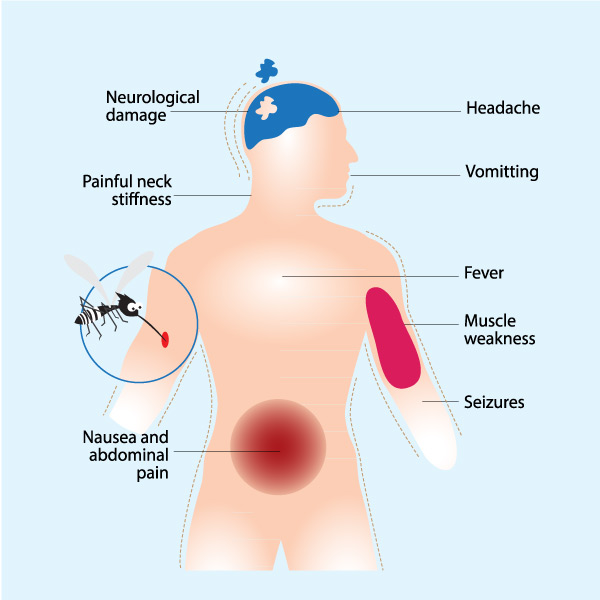 je-symptoms