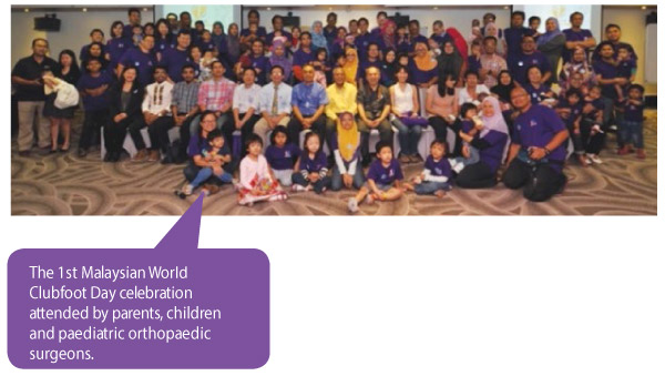 first-malaysian-world-clubfoot-day