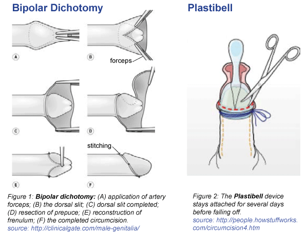 The Foreskin  HowStuffWorks