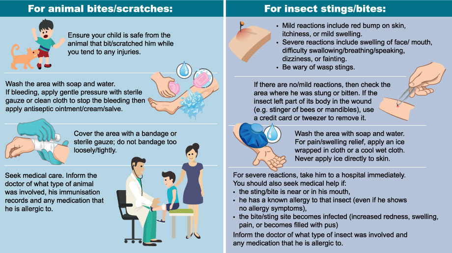 first aid treatment for animal bites