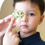 A child with right eye patching therapy for his left ‘lazy eye’