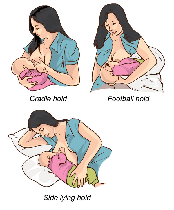 Sore and Cracked Nipples in Breastfeeding Mothers – A Proven