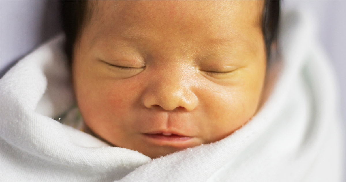 Jaundice Explained: Cause And Solutions To Reduce Jaundice In Babies ...