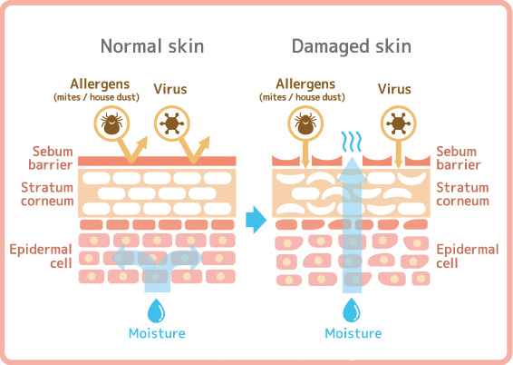 Normal Skin vs Damage Skin